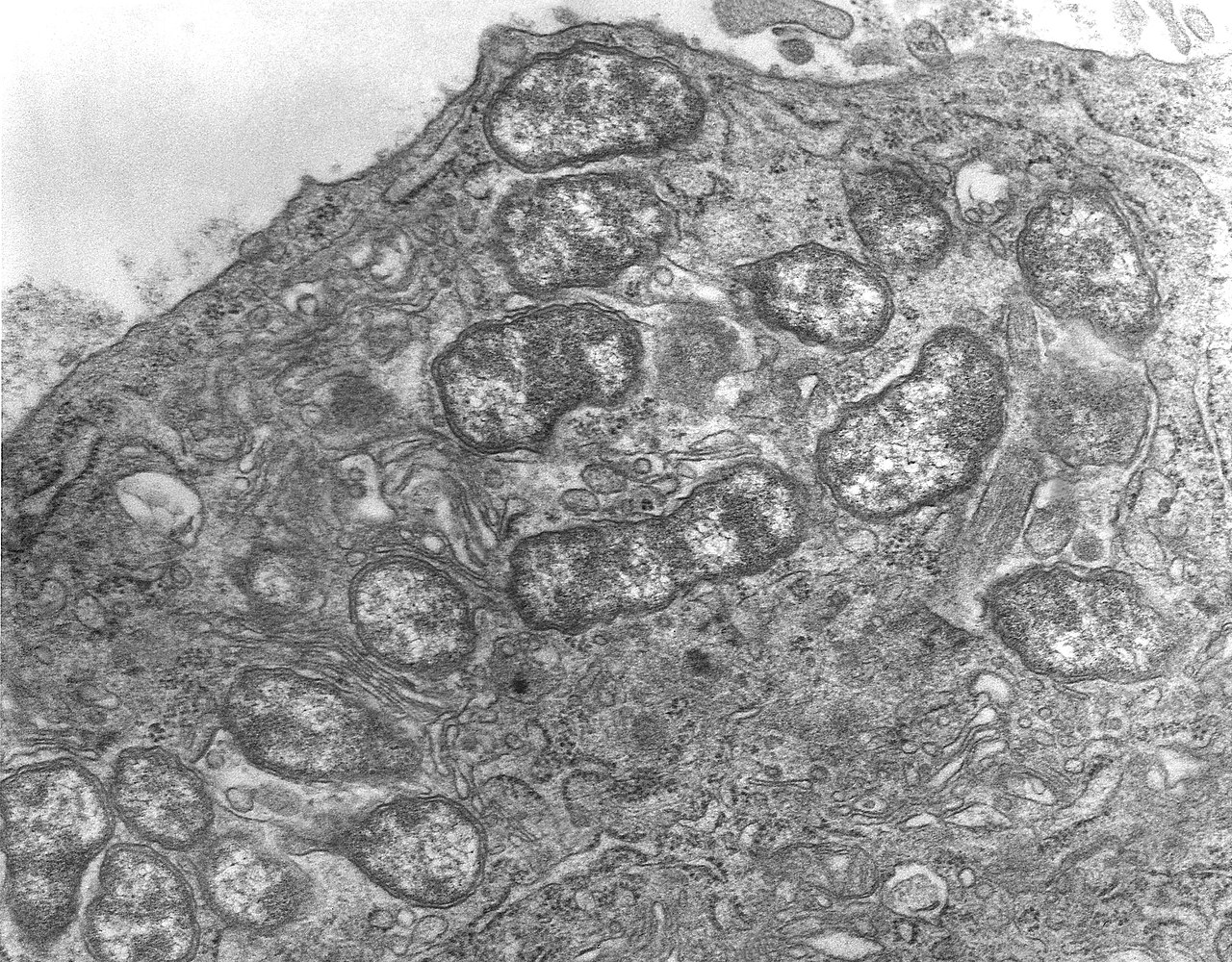 TEM image of Orientia tsutsugamushi in an infected cell. Public domain.