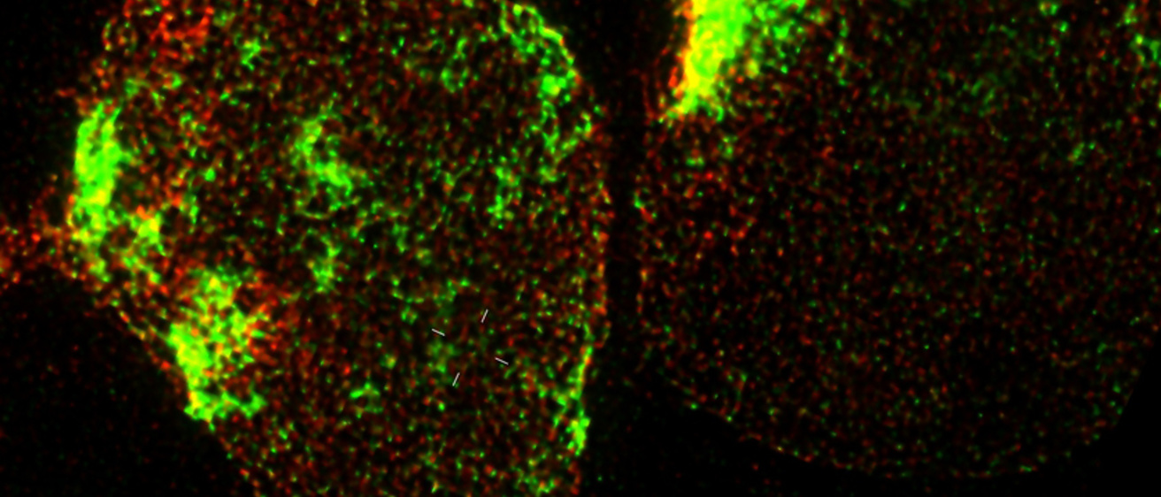 Fluorescent microscopy image depicting chlamydial inclusion.